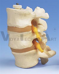 3 Lumbar Vertebrae, flexibly mounted